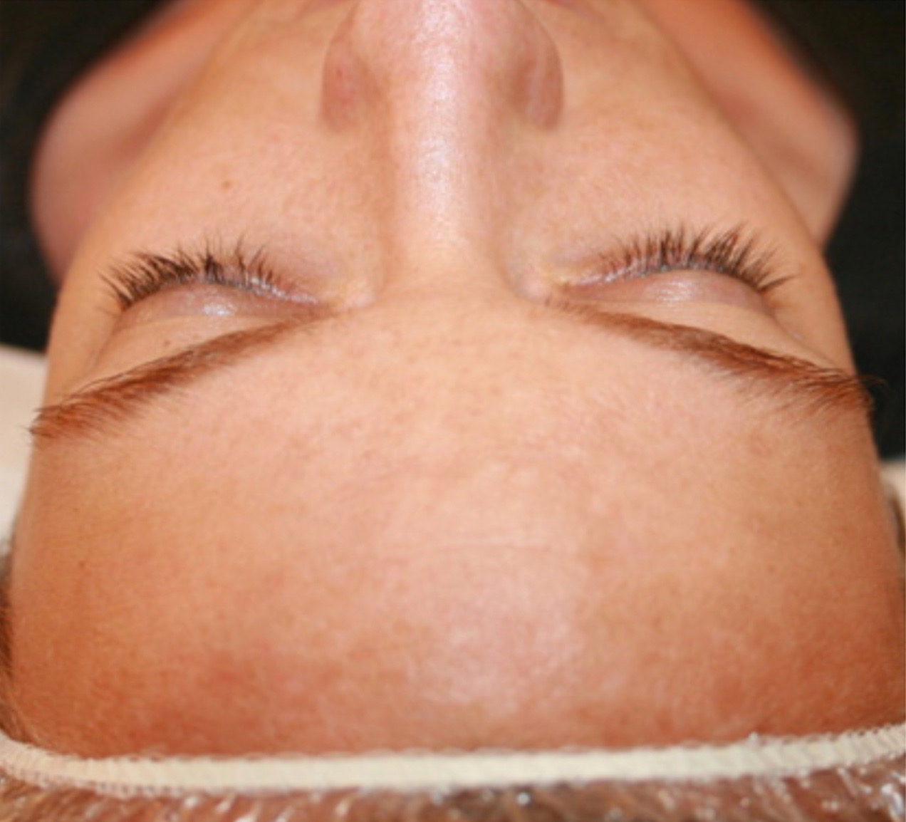 C3 Clinical Corrective Care Sun Damage Sunspots Aging