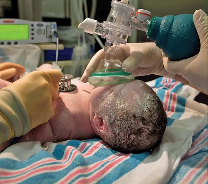 My Family Medicine Practice Neonatal Resuscitation Procedure