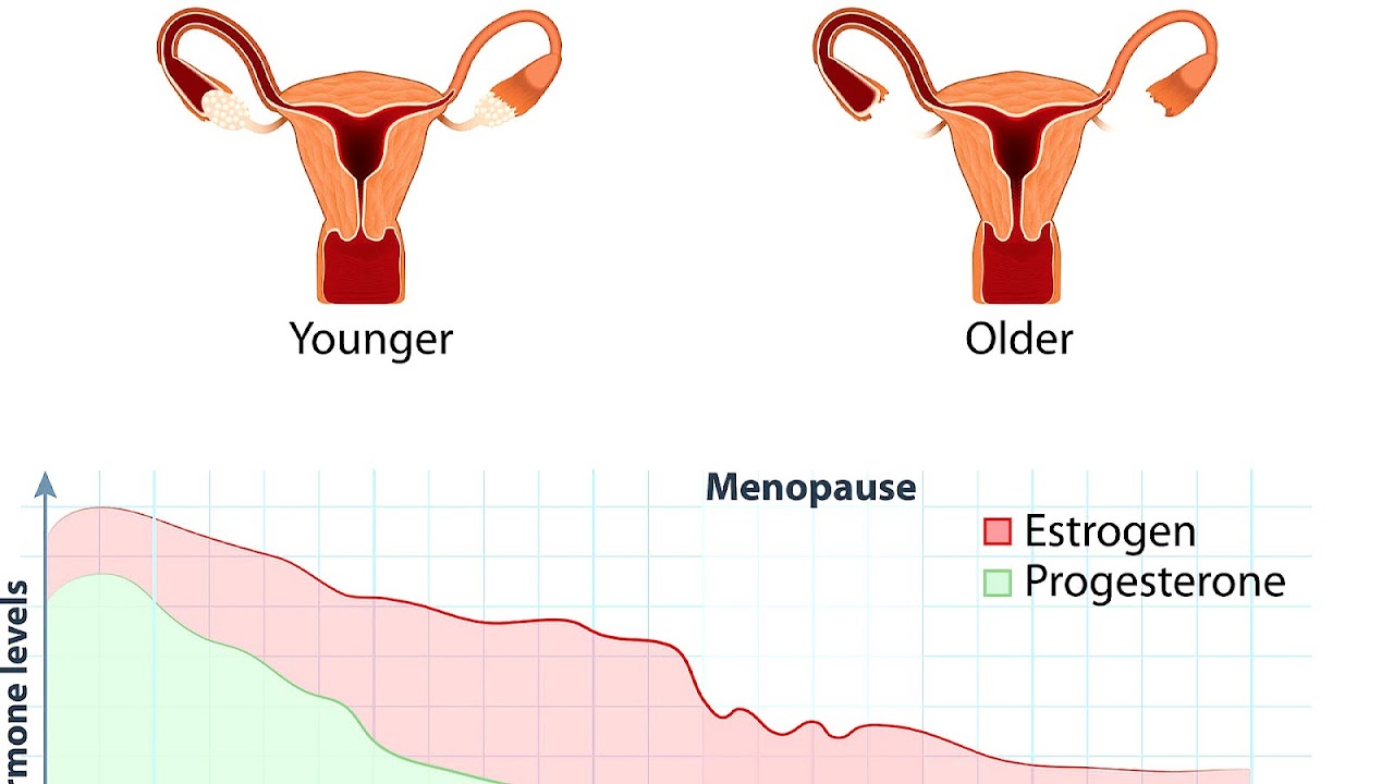 Common Age For Menopause Menopause Choices
