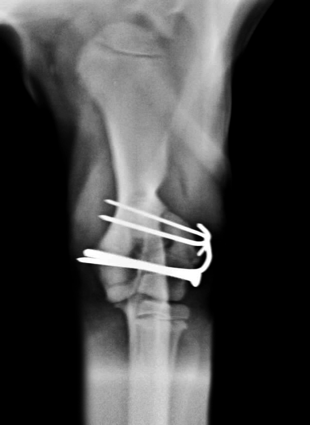 ARTROVET: Fractura del proceso lateral del cóndilo humeral