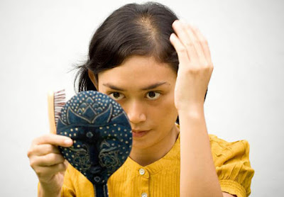 hair thinning due to PCOS