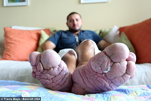 man with largest feet