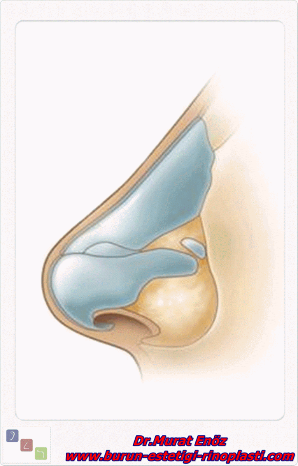 Burun Törpüleme Ameliyatı