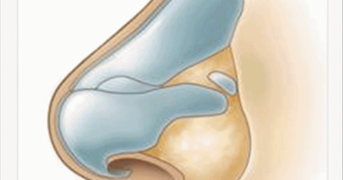 Burun Törpüleme Ameliyatı