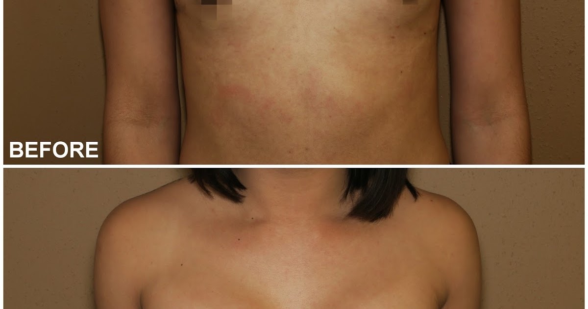 Mtf nipple changes, dad cums in young daughter