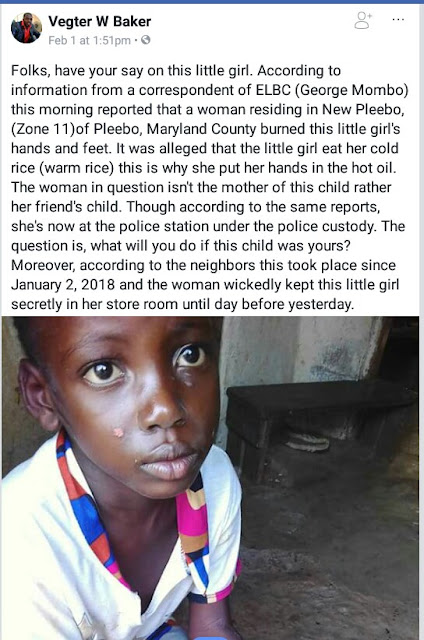 Photo: Woman burns little girl