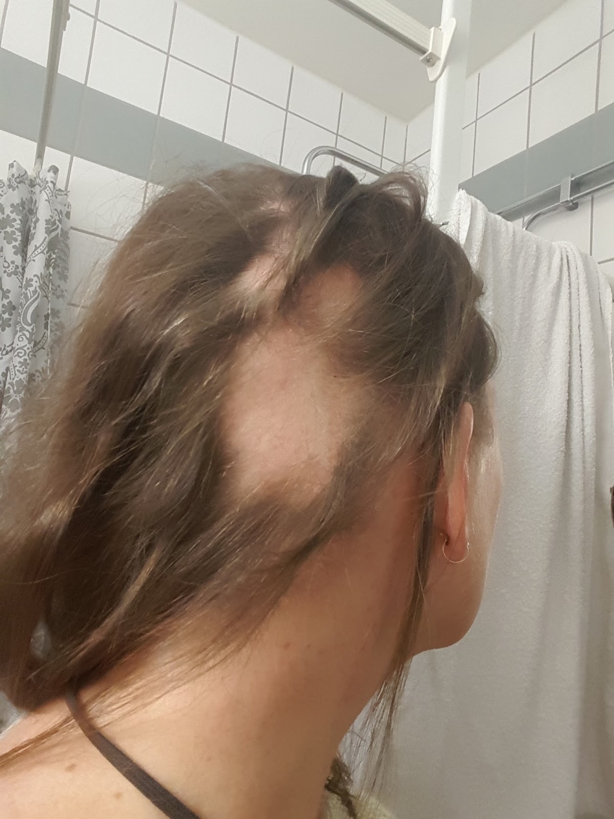 tappa hår fläckvis av stress tappa hår fläckvis av stress