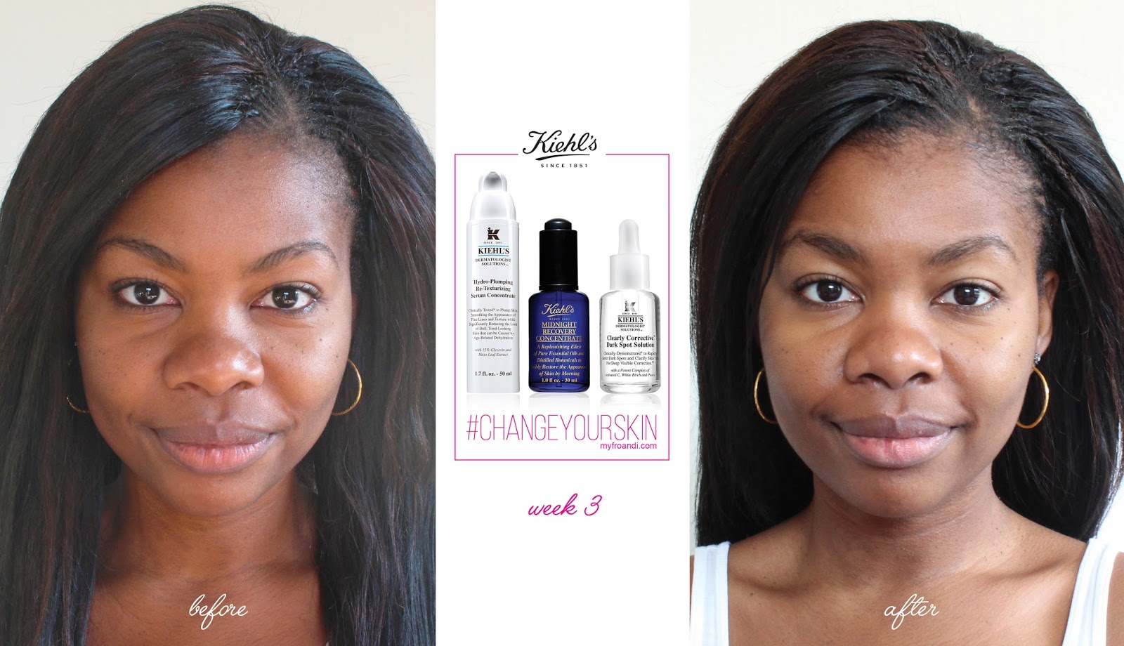 kiehl's midnight recovery before and after