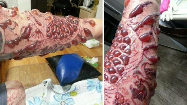 Niatnya Ingin Tampil Sangar Dengan Tato, Tapi yang Dialami Pria Ini Sungguh Mengenaskan Niatnya Ingin Tampil Sangar Dengan Tato, Tapi yang Dialami Pria Ini Sungguh Mengenaskan