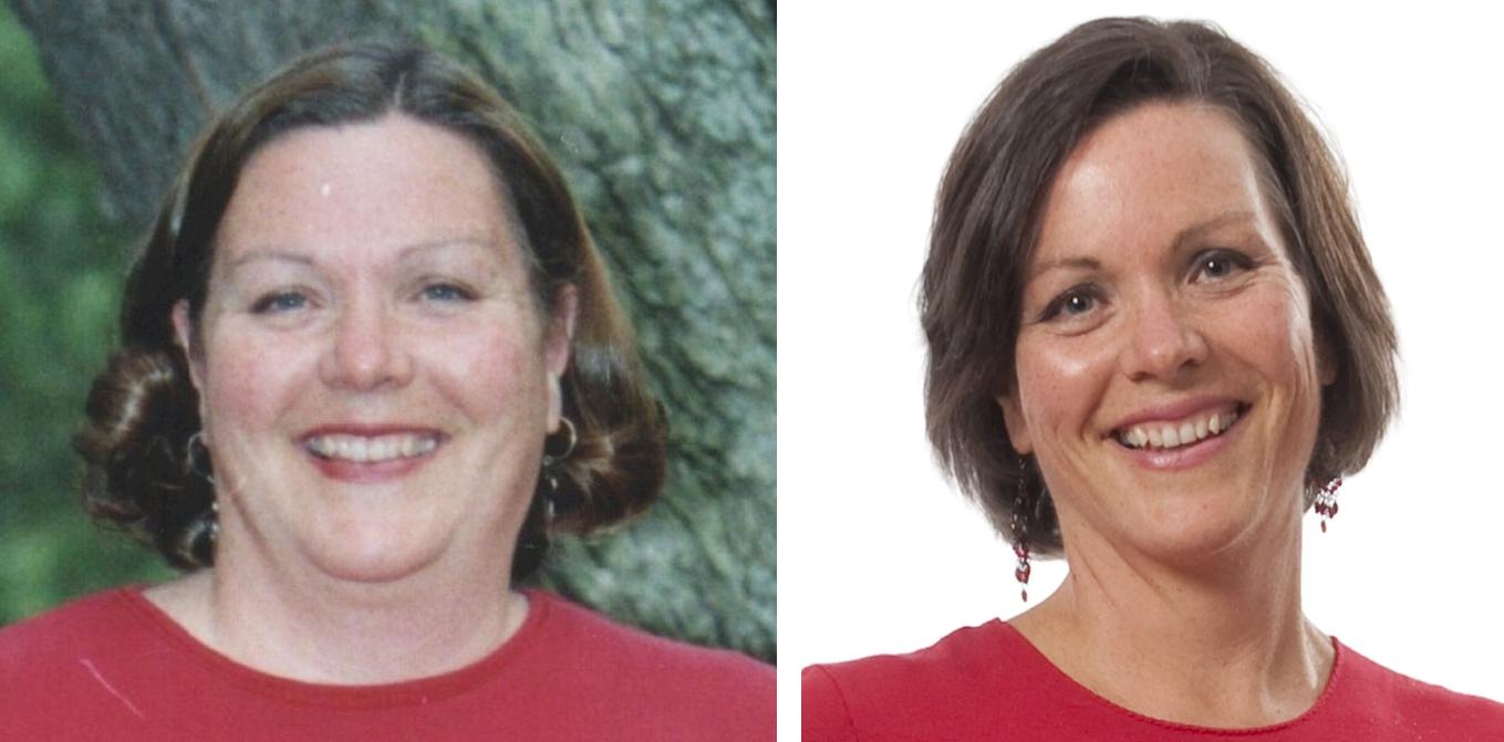 My Metabolic Syndrome how come your skin looks so good?