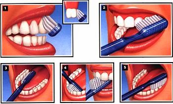 Técnica de cepillado de dientes