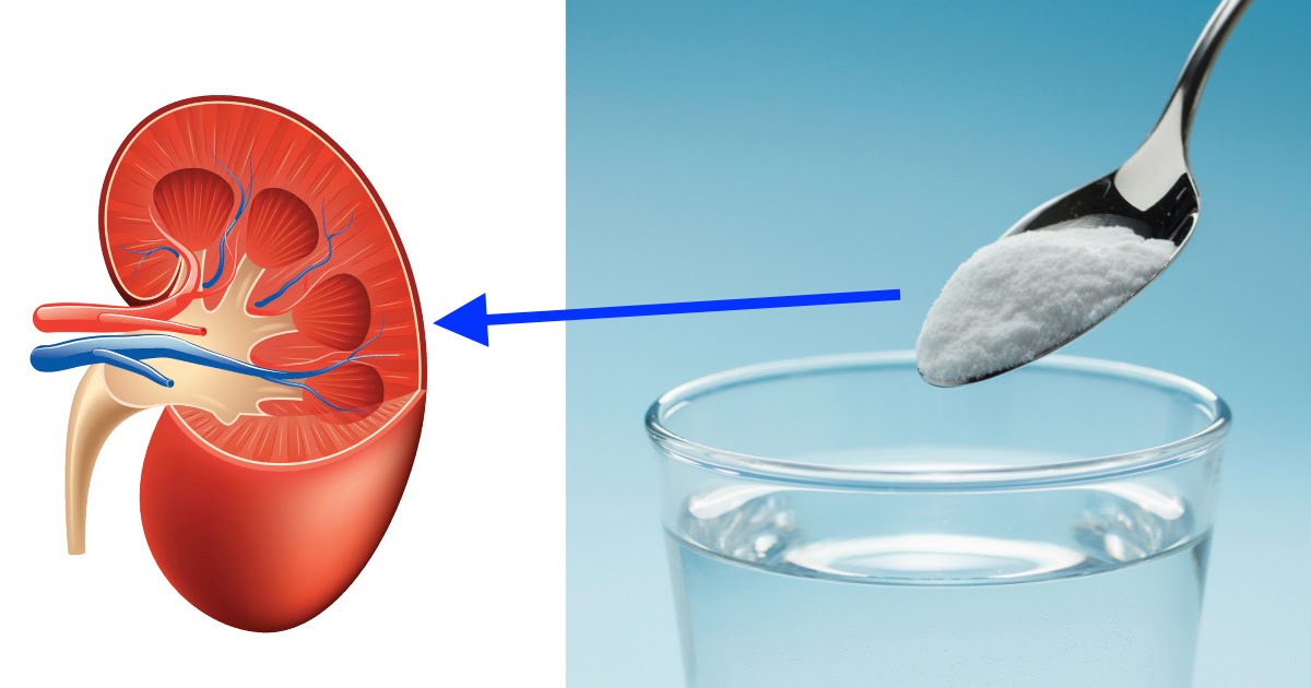 How to Repair Your Kidneys Naturally Using Baking Soda