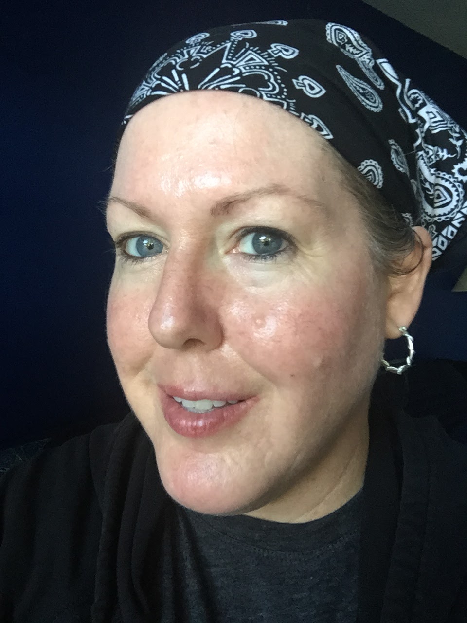 My Journey Through Topical Chemotherapy Fluorouracil 5 Cream and