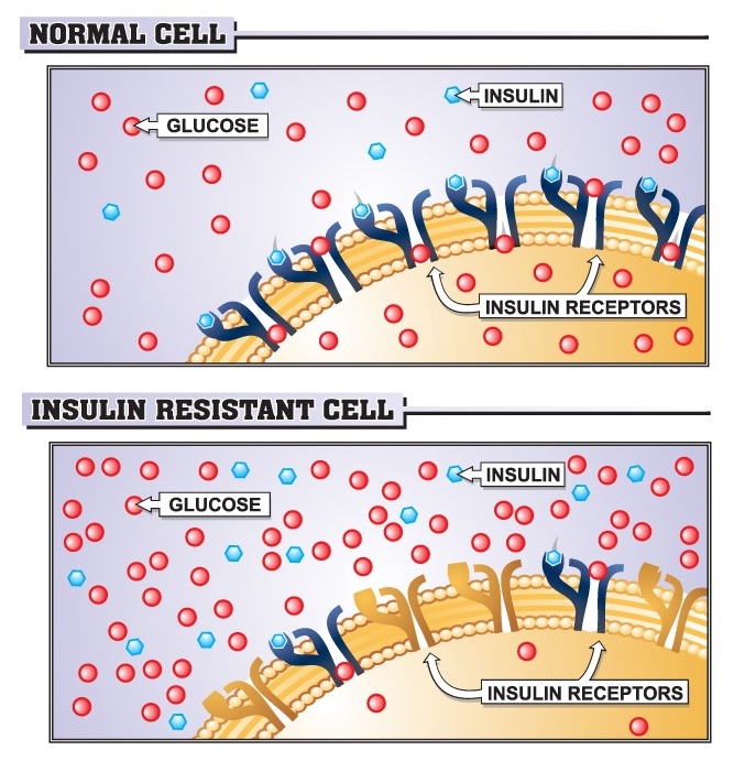 dieta para sindrome metabolica resistencia insulinica pdf
