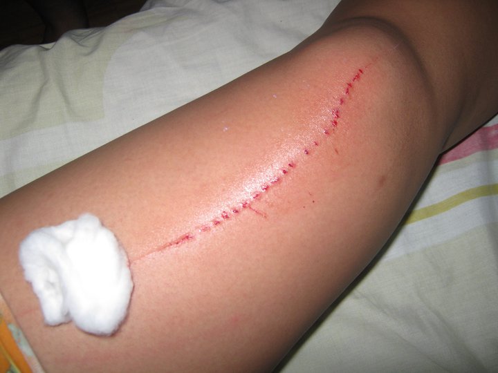 Human Heart Nature Sunflower Beauty Oil and my armpits