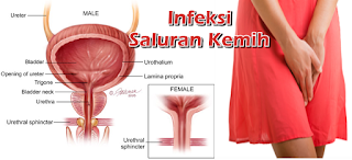 sakit saat buang air kecil dan penis bengkak