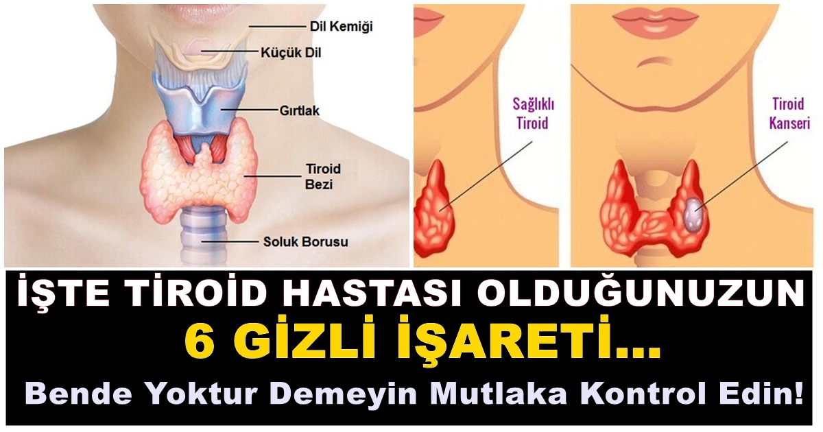 iste tiroid hastasi oldugunuzun 6 gizli