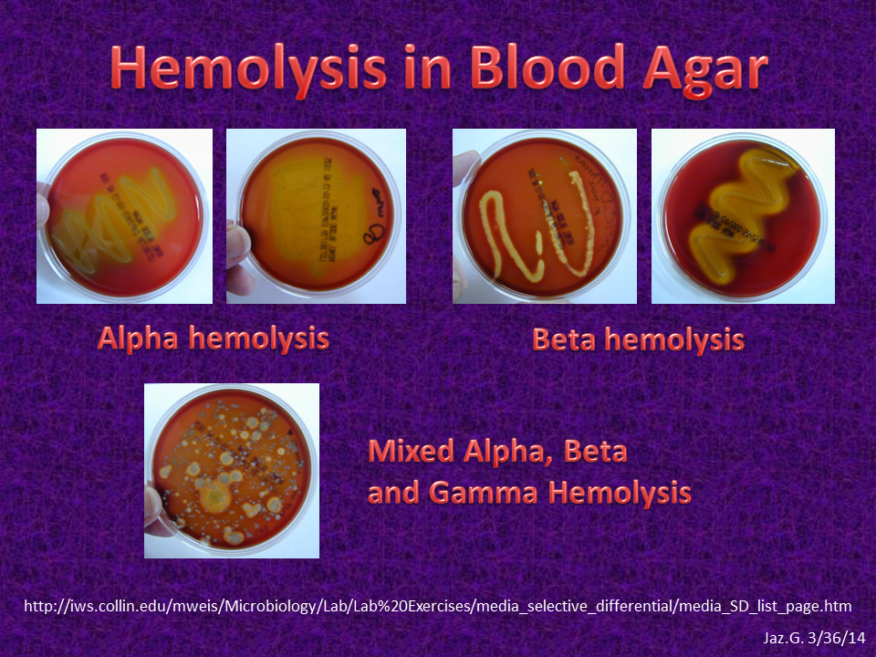 veterinary-ebooks-and-lecture-notes-free-hemolysis-in-blood-agar