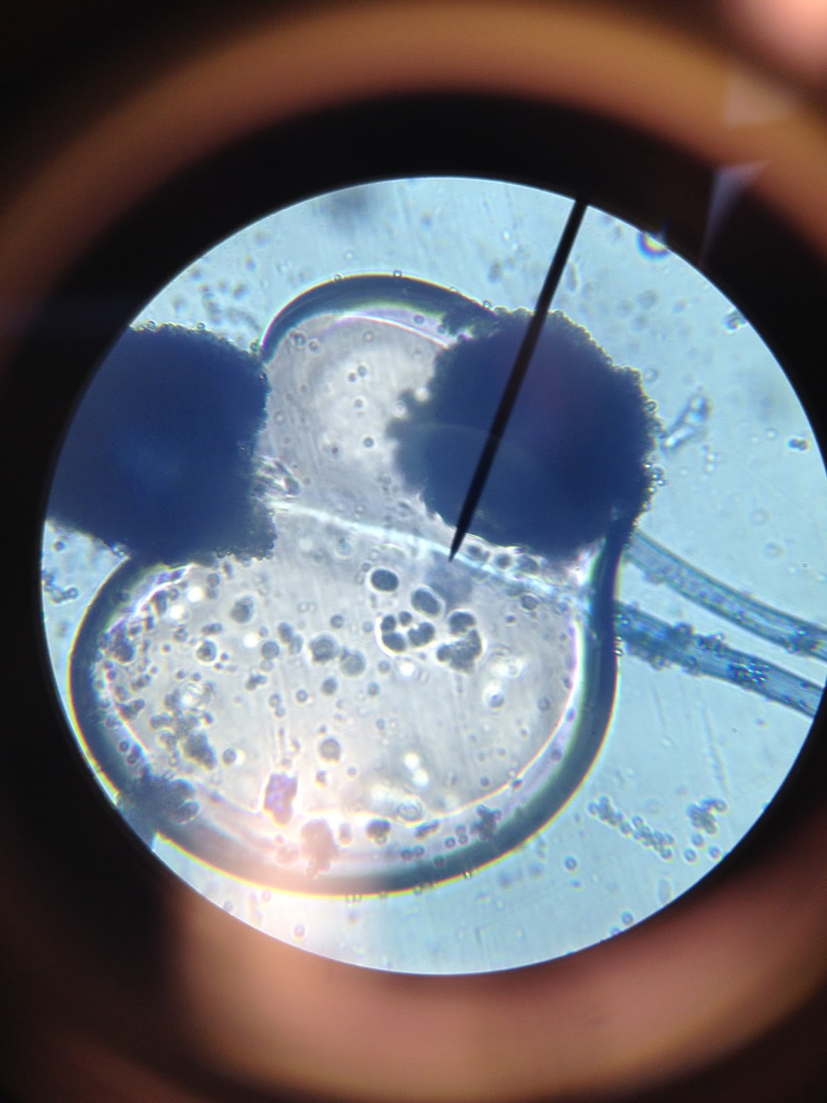 The Cinnamon Note Under The Microscope