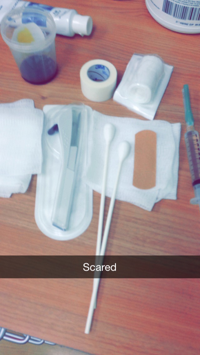 The Bright's Side My Nexplanon Experience