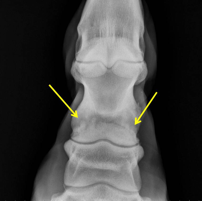 Michael Porter, Equine Veterinarian High Ring Bone!! Michael Porter, Equine Veterinarian High Ring Bone!!