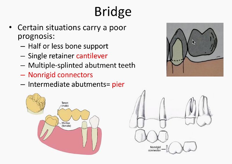 PROSTHODONTICS General Considerations