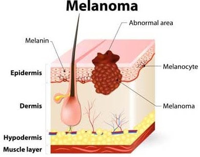 Cara Mengolah Daun Kelor dan Manfaatnya bagi kesehatan manfaat teh daun kelor, manfaat daun kelor untuk kanker, gambar daun kelor, cara mengolah daun kelor, manfaat daun kelor bagi kesehatan dan kecantikan, daun kelor adalah, efek samping daun kelor, manfaat daun kelor untuk rahim