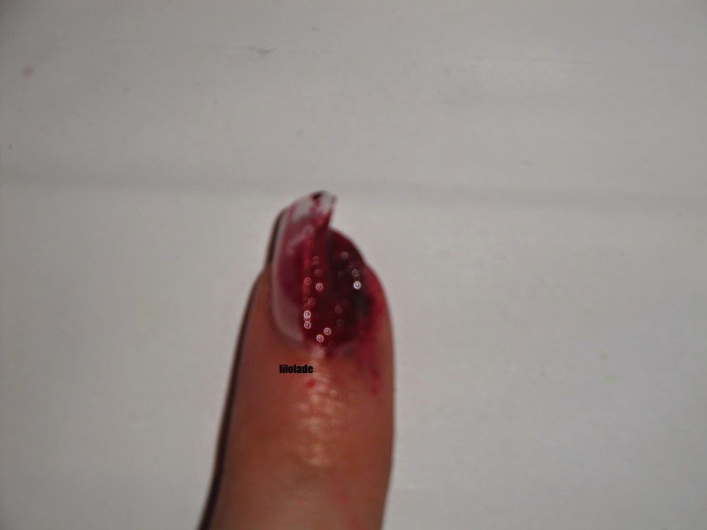 Nagel Abgerissen Nachwachsen Nageldesign Bilder