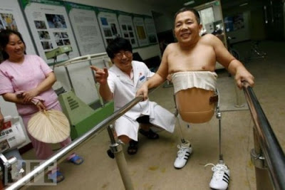 Kisah Perjuangan Hidup Pria Bertubuh Separuh Kisah Perjuangan Hidup Pria Bertubuh Separuh