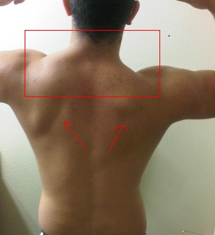 Men's Corner Four ways to correct muscle imbalance