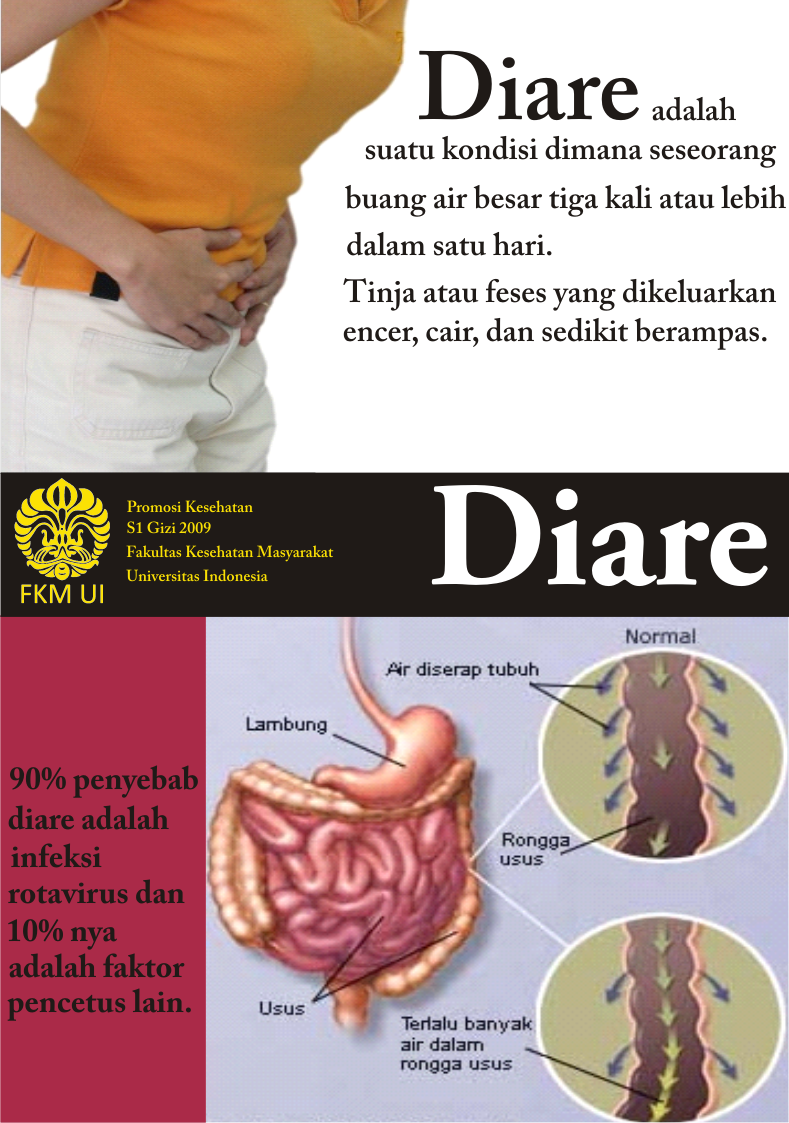 TIPS cara mengobati mencret (diare) dengan mudah dan tidak bikin repot