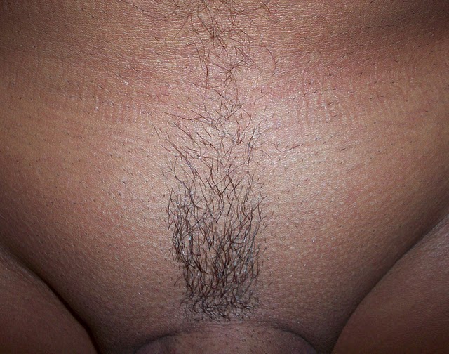 Hairy Pubic Area 48