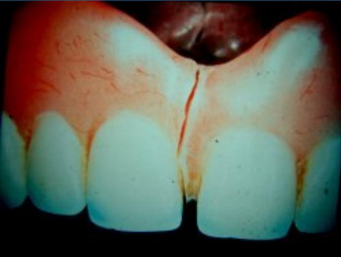 dental repair fx dental repair fx