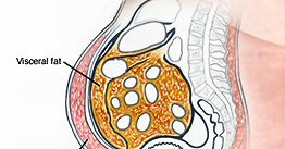 visceral fat