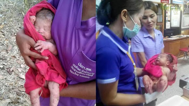 Kejam! Bayi Ini Ditusuk 14 Kali dan Dikubur Hidup-Hidup, Ditemukan Masih Hidup Keadaanya Miris Kejam! Bayi Ini Ditusuk 14 Kali dan Dikubur Hidup-Hidup, Ditemukan Masih Hidup Keadaanya Miris