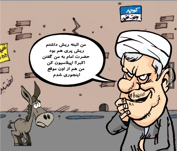 اپيلاسيون عورت