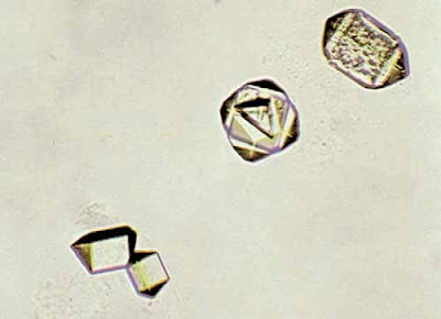 Triple phosphates crystal and amorphous phosphates