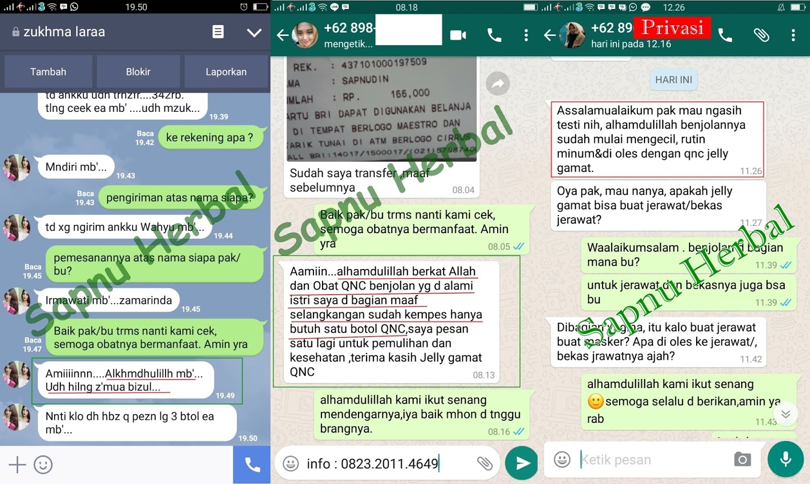 Cara Mengobati Bisul Di Dalam Telinga Secara Alami Sampai Tuntas