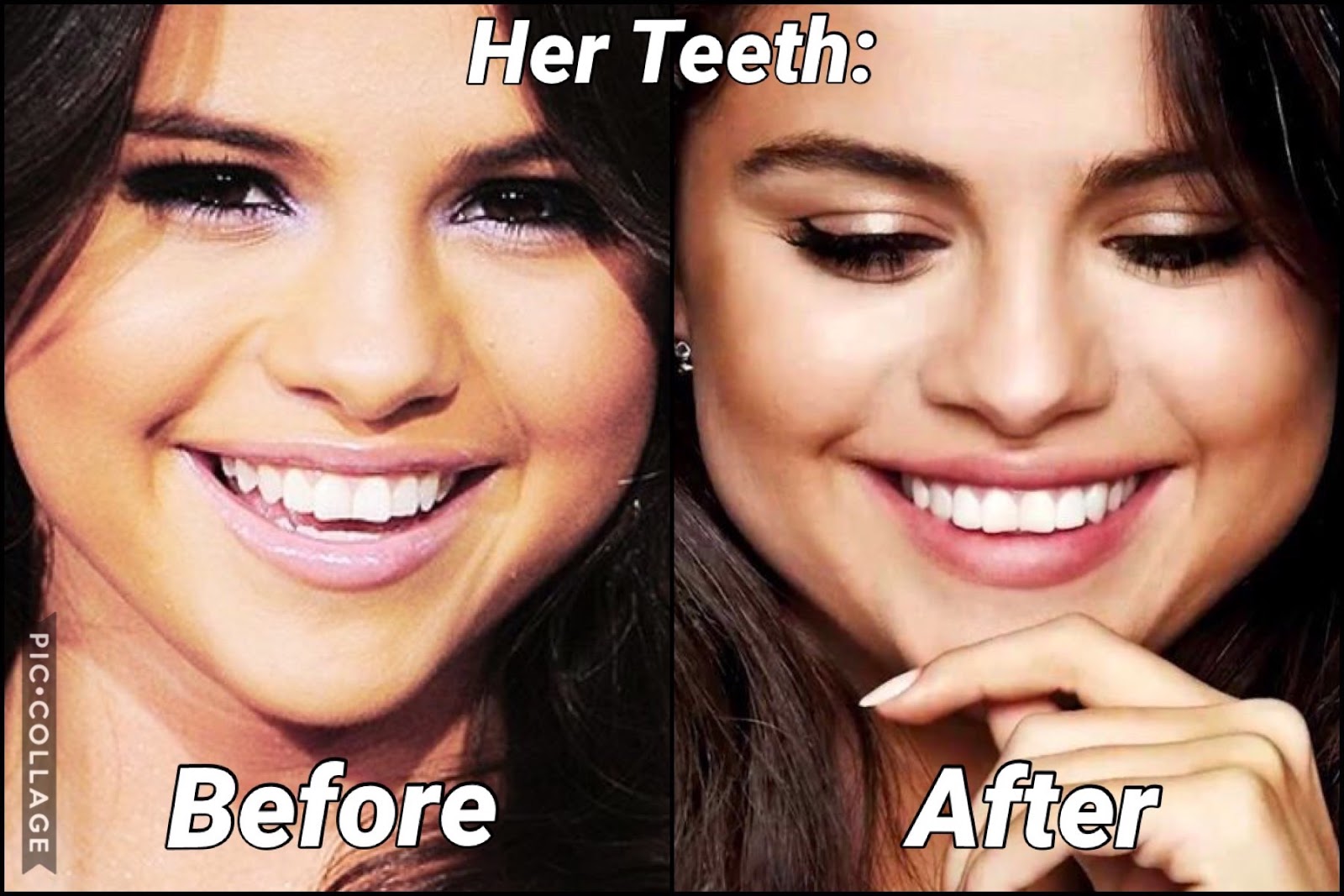 The 411 Dirt: Did You Know Selena Gomez Has VENEERS?! *2019*
