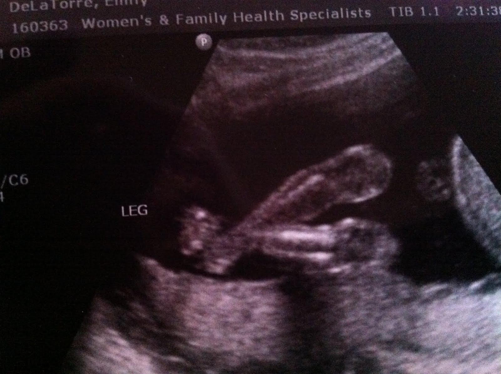The De La Torre Family 20 Week Ultrasound May 25, 2011