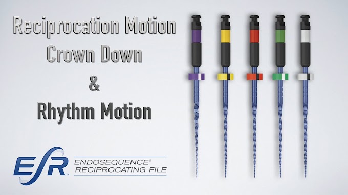 ENDODONTIC: EndoSequence Reciprocating File (ESR) - Dr. Nasseh