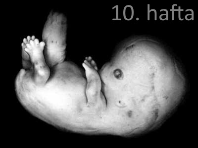 10 haftalık gebelik görüntüsü