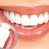 Tips Perawatan Gigi Yang Akan Membuat Gigi Lebih Sehat