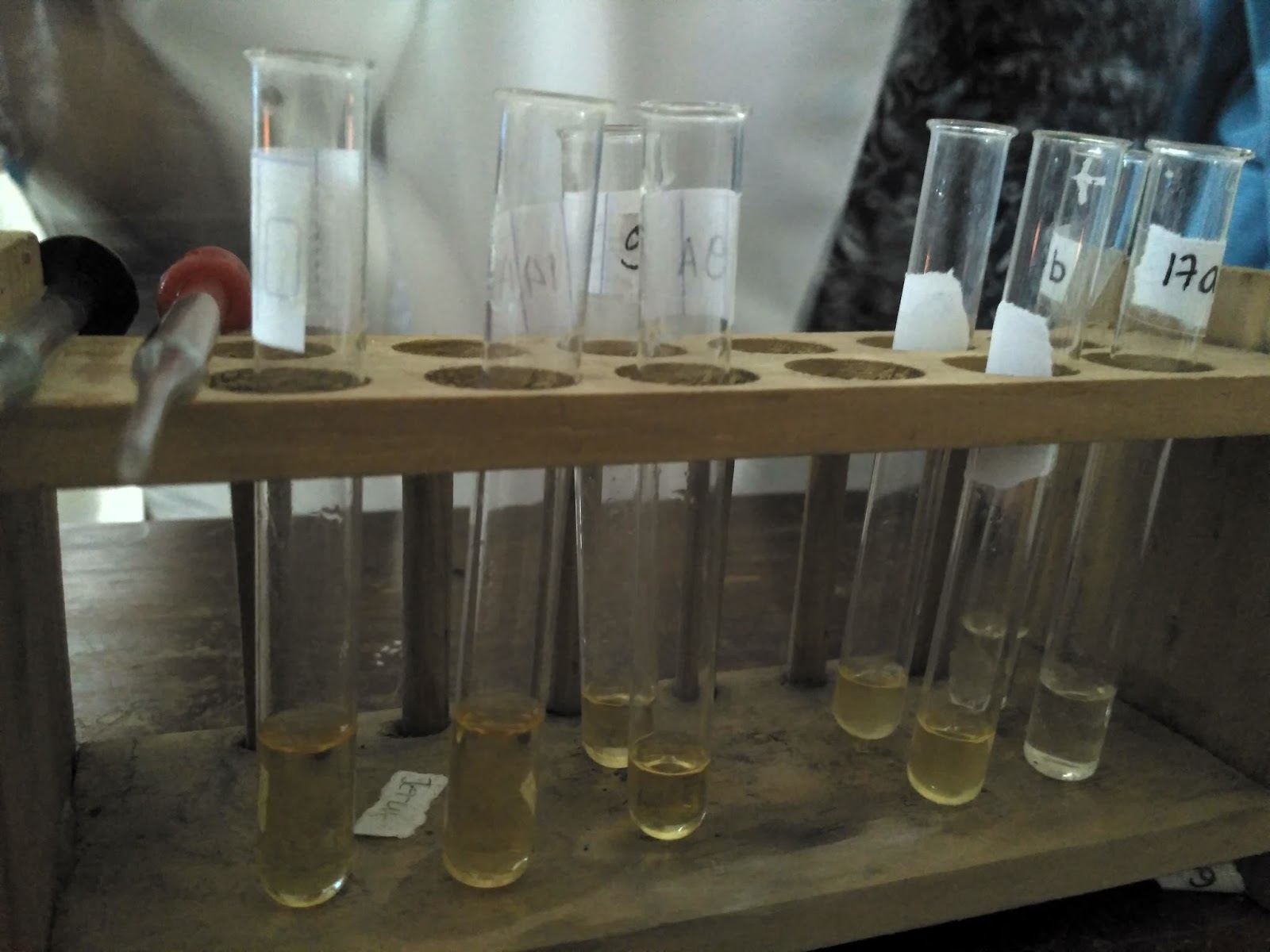 Uji Kandungan Gula dan Protein dalam Urine SCIENCE Uji Kandungan Gula dan Protein dalam Urine SCIENCE