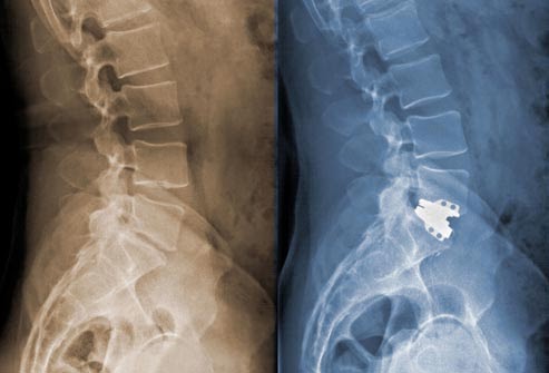 dolor en el lado derecho debajo de la caja torácica peor al acostarse
