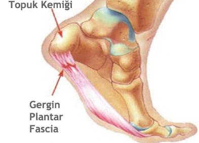 topuk dikeni neden olur