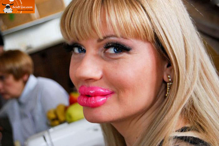 Blog Do Mochi Colocar Muito Botox Deixa Tudo Meiaboca