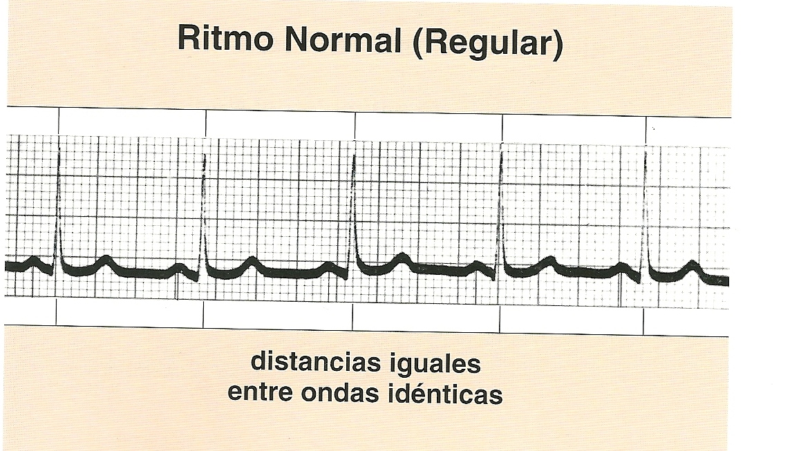 Dr. Rafael Soto Electrocardiografía Cardiología clínica Ritmo sinusal Dr. Rafael Soto Electrocardiografía Cardiología clínica Ritmo sinusal