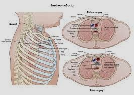 Medical Treatment Pictures-for Better Understanding ...
