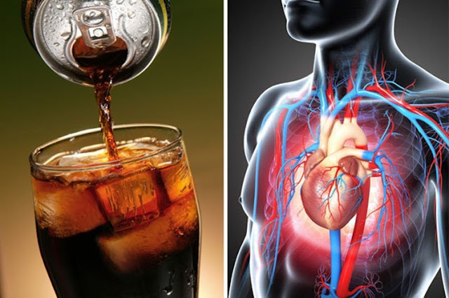 Cuaca Panas Paling Enak Minum Soda Dingin, Tapi Banyak Orang Tidak Tahu Ini yang Terjadi Pada Tubuh Cuaca Panas Paling Enak Minum Soda Dingin, Tapi Banyak Orang Tidak Tahu Ini yang Terjadi Pada Tubuh